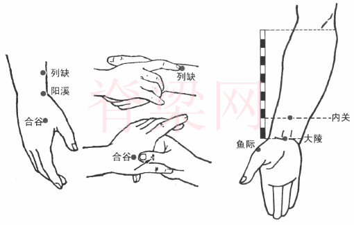 艾炙治疗狭窄性腱鞘炎